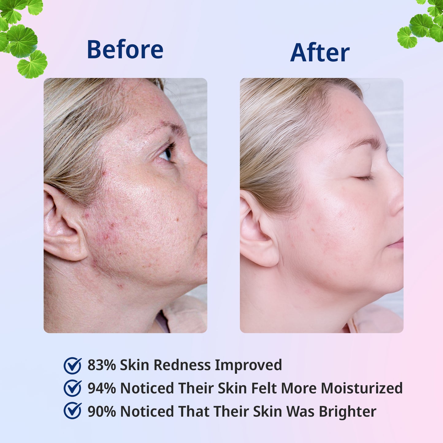 Bio-Collagen Deep Mask - Anti-Wrinkle Lifting Mask for Deep Collagen Renewal