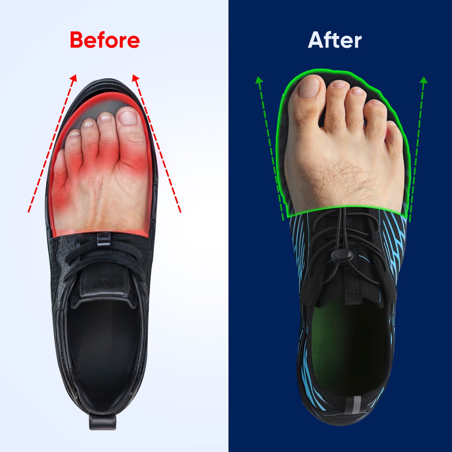 Non-Slip Barefoot Shoes for Healthy Feet (Unisex) - Buy 1 Pair Get 1 FREE