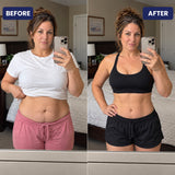 Skinsculpt™ 3-IN-1 Sculpting Device