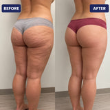 Skinsculpt™ 3-IN-1 Sculpting Device