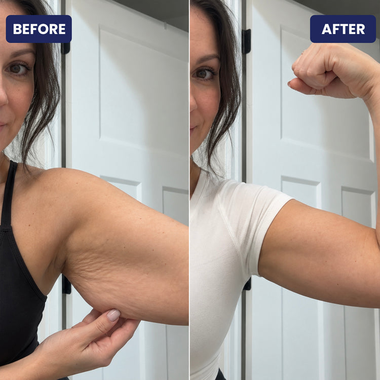 Skinsculpt™ 3-IN-1 Sculpting Device